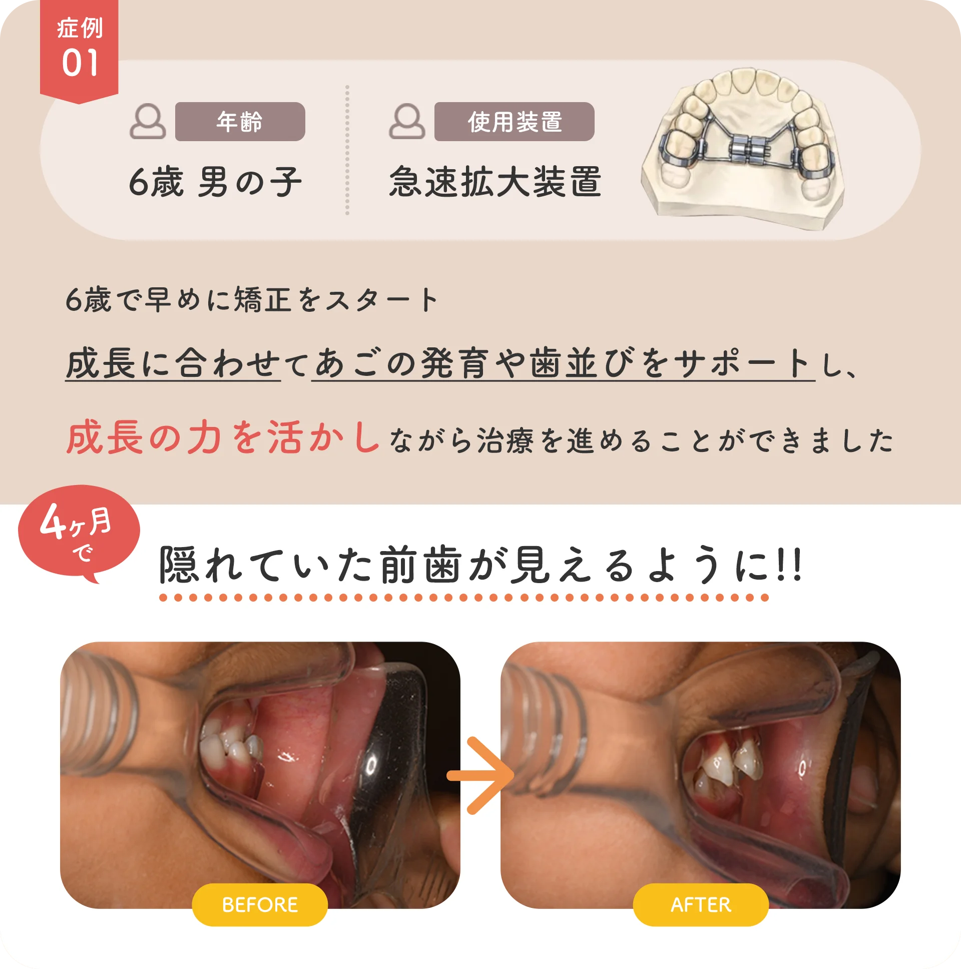 examples