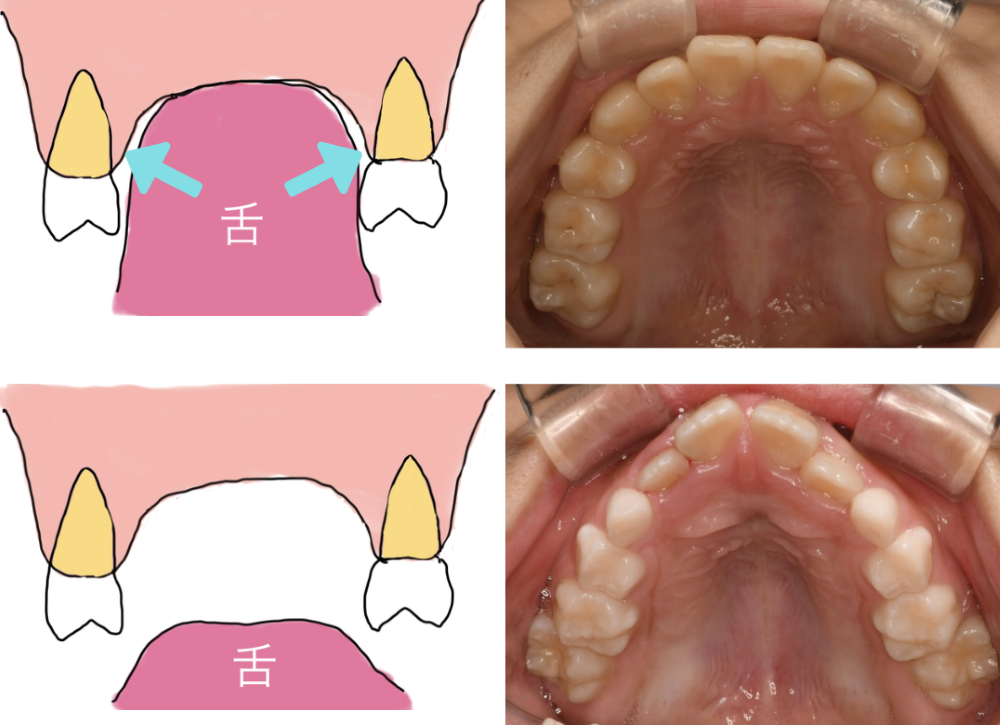 alt_text