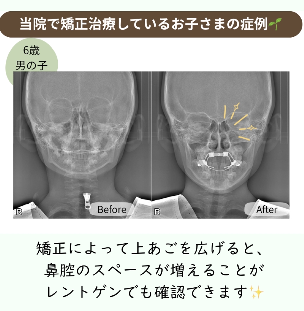 image_tooltip 症例
