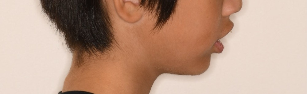 image_tooltip 骨格や歯の位置、舌、呼吸まで含めて診断することが重要